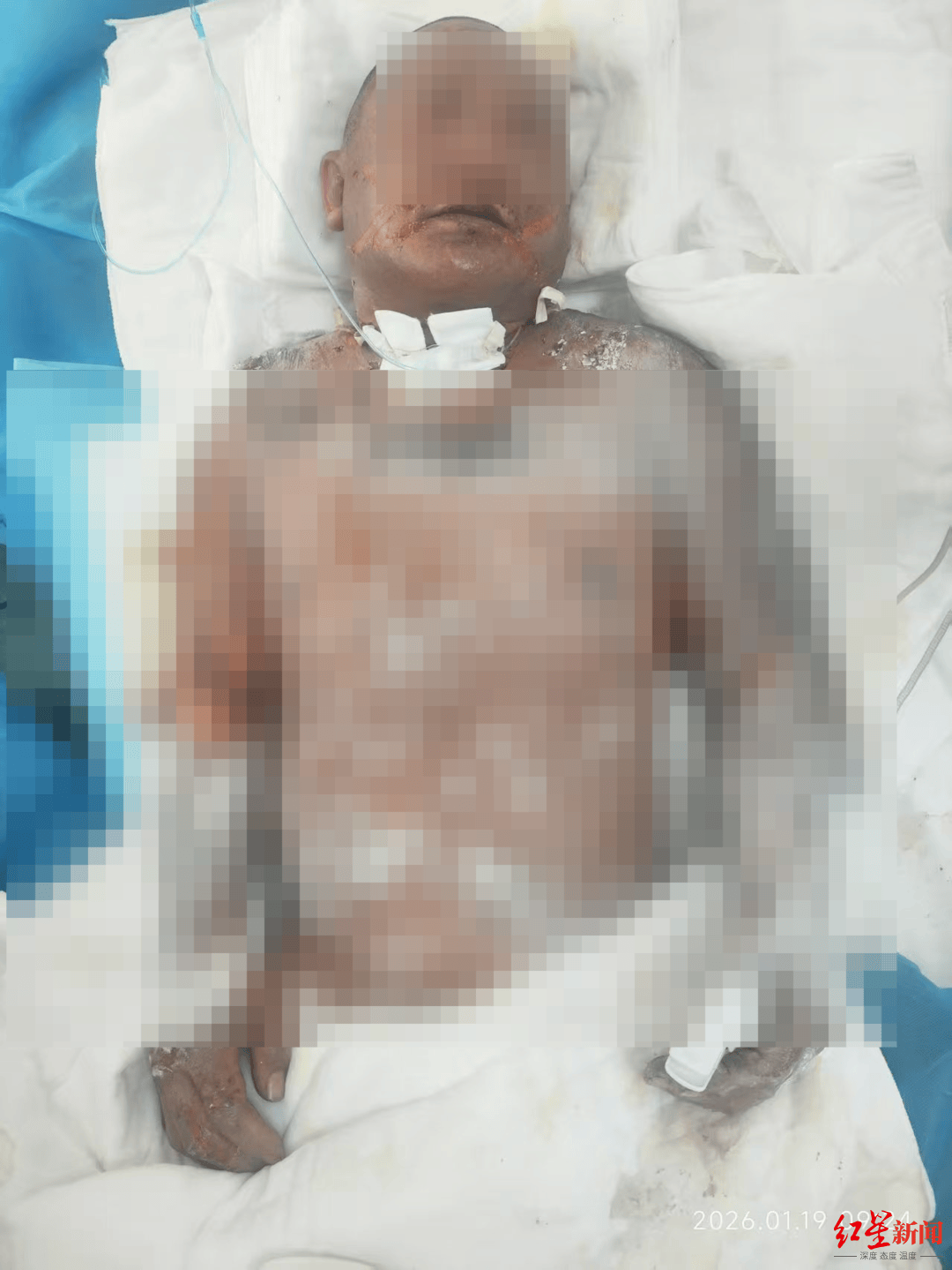 信用网皇冠申请注册_灌装燃气次日爆炸 丹东一对夫妻重度烧伤 新房成危房 家属:二人还在抢救